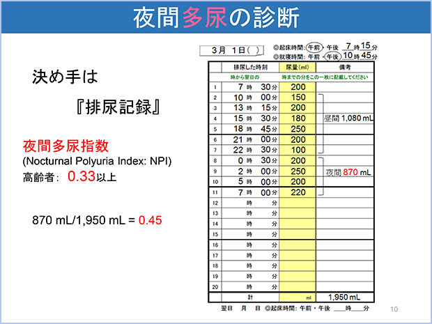 夜間多尿の診断